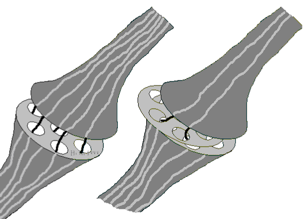 Synapses are variable valves in an information channel.
